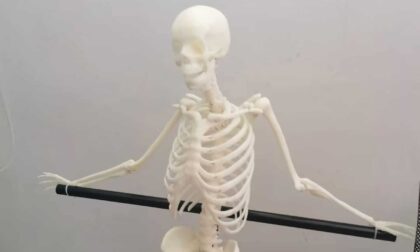 3D Printed 1/3 Human Skeleton Model for Medical School Anatomy Class